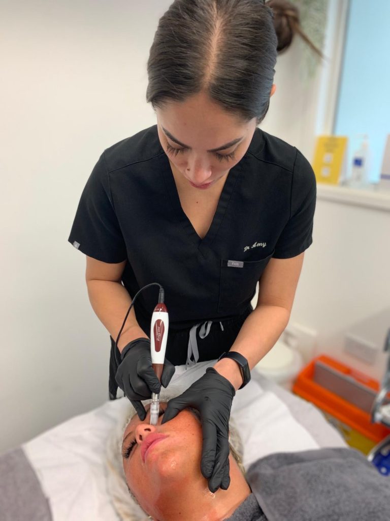 microneedling Dr Amy Law Cosmetic Clinic Liverpool