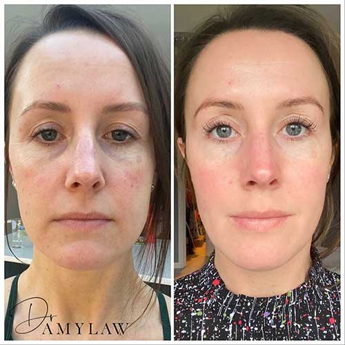 pack2 Dr Amy Law Cosmetic Clinic Liverpool