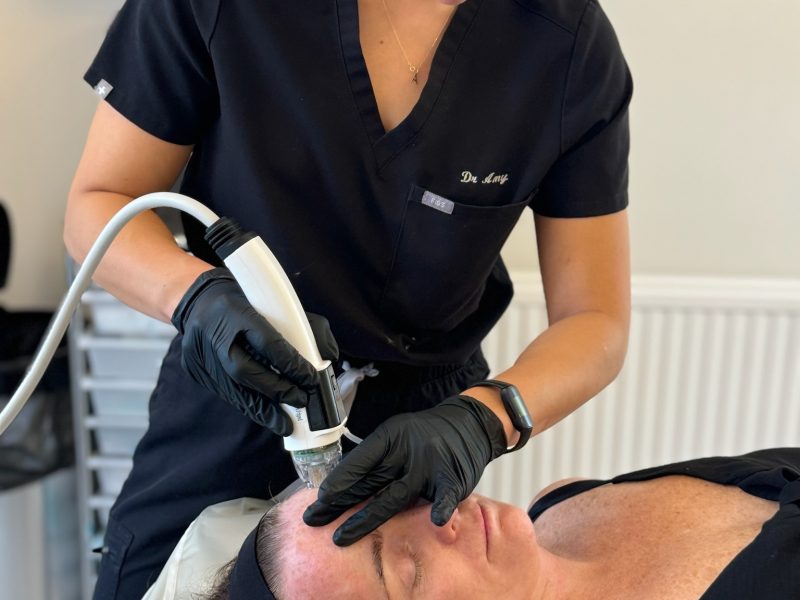 Radiofrequency Microneedling collagen stimulator Dr Amy Law Cosmetic Clinic Liverpool