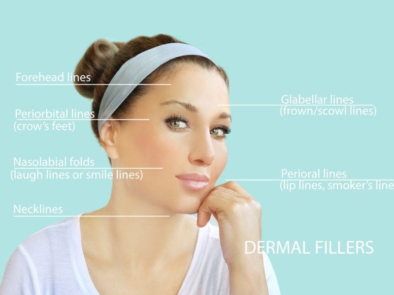 Dermal filler