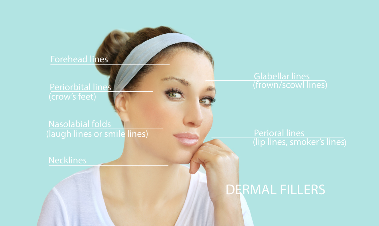 Dermal filler